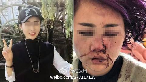 丽江被打女孩最新动态关注更新🌹