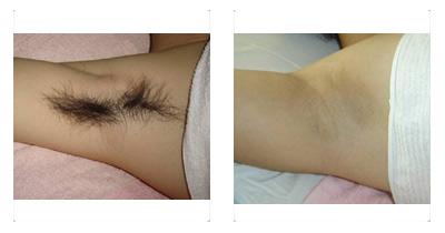 最新腋毛图,深度解析视觉现象